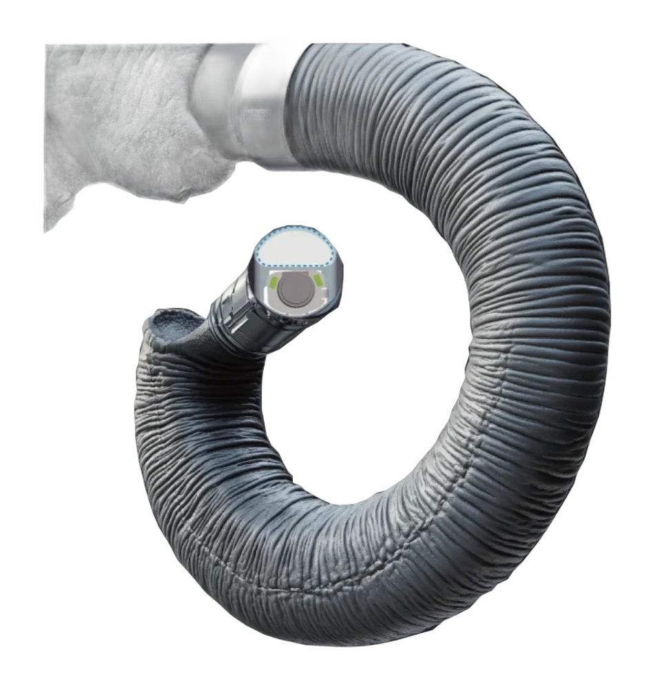 Vathin Single Use Flexible Bronchoscope EleBALScope Series — gambar 4